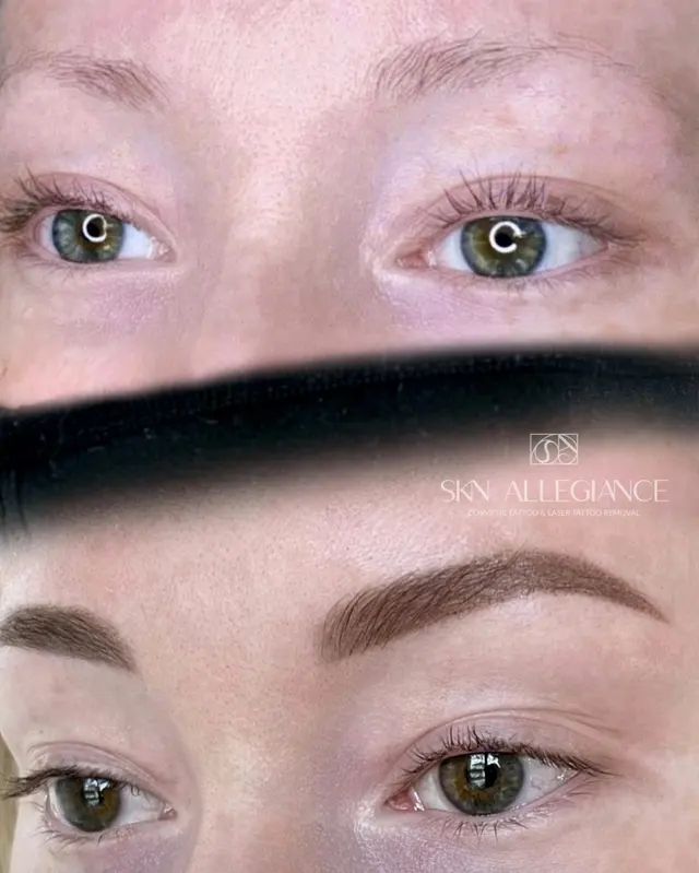 SKN ALLEGIANCE Laser tattoo & Permanent makeup removal — photo from the business 9