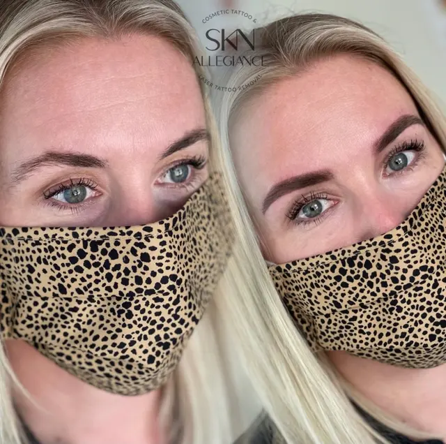 SKN ALLEGIANCE Laser tattoo & Permanent makeup removal — photo from the business 2