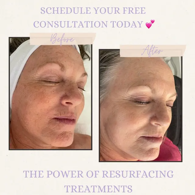 Beauty in Bloom Esthetics LLC — photo from the business 8