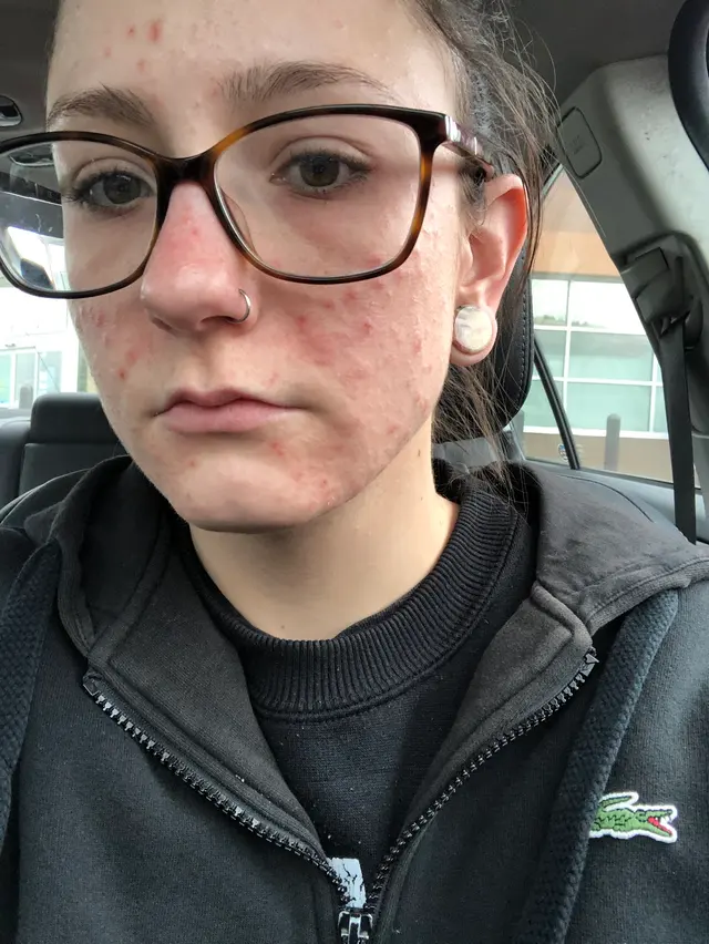 Joseph B. Bikowski, MD — customer photo 4