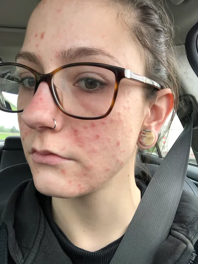 Joseph B. Bikowski, MD — customer photo 5