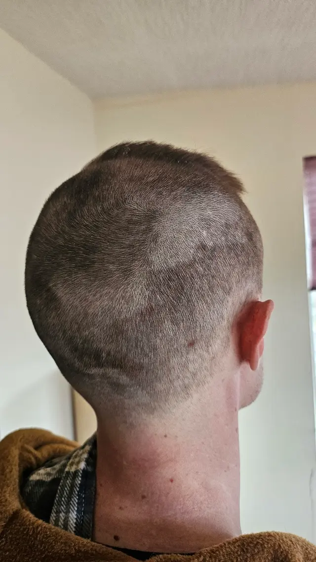 Globe Hair — customer photo 10