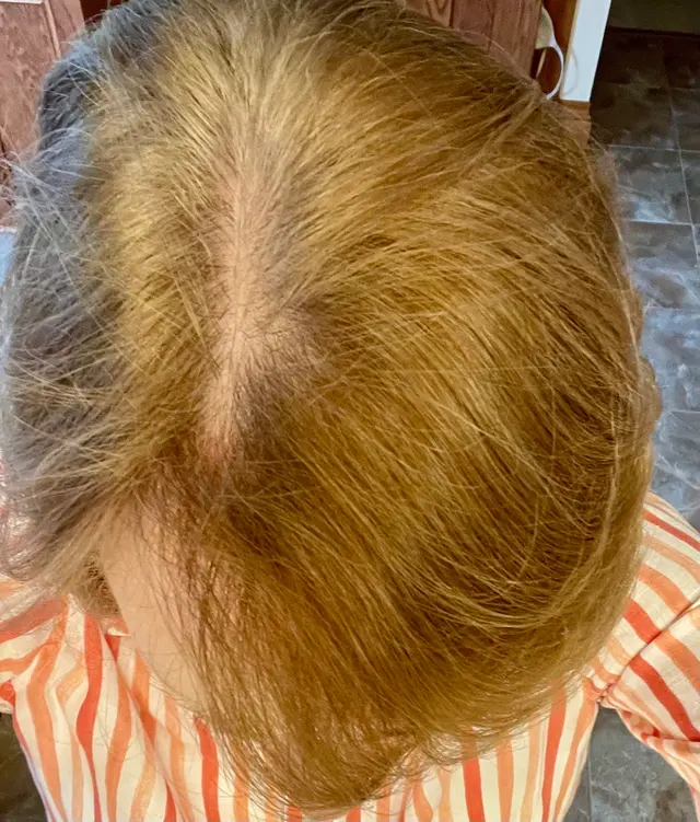 REVIVE Salon and Medspa — customer photo 6