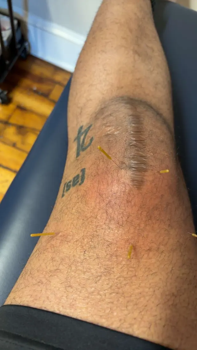 Bull City Physical Therapy Charlotte — customer photo 11