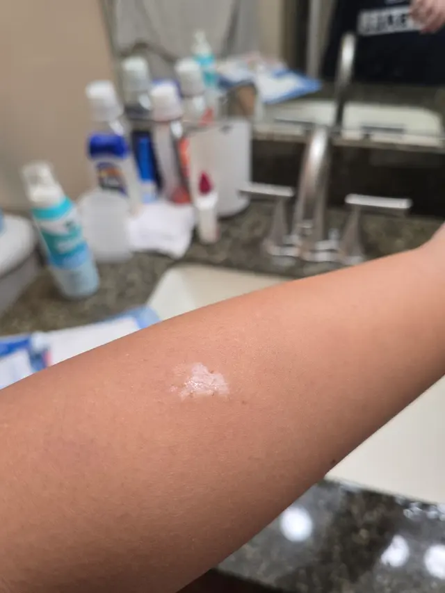 Customer photo of work by Thrive Proactive Health, from jiu jai's review