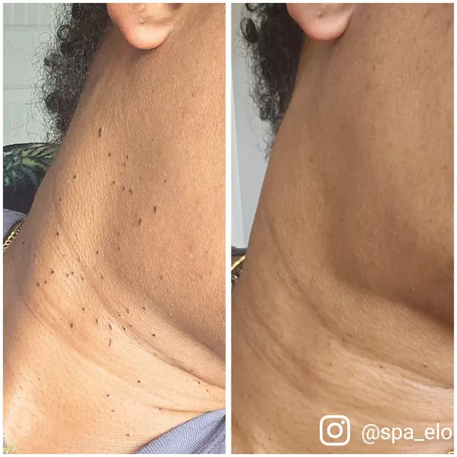 Spa Eloni — photo from the business 3