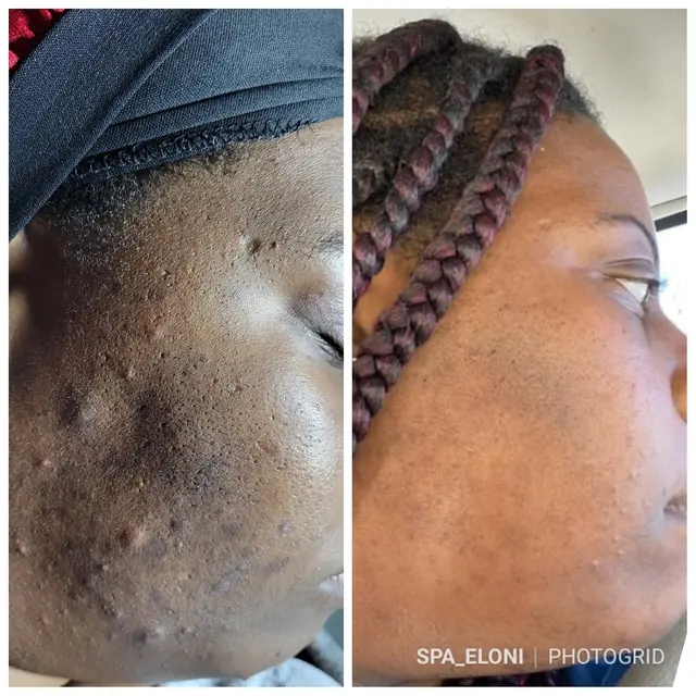 Spa Eloni — photo from the business 5