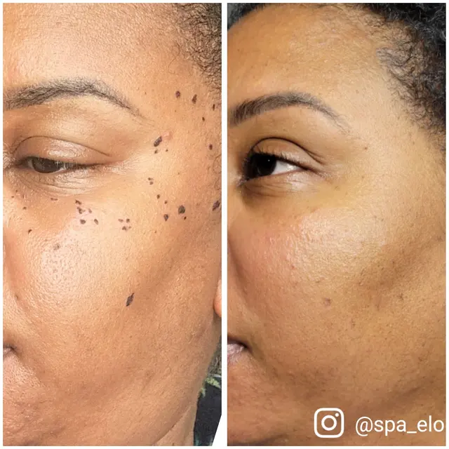 Spa Eloni — photo from the business 8