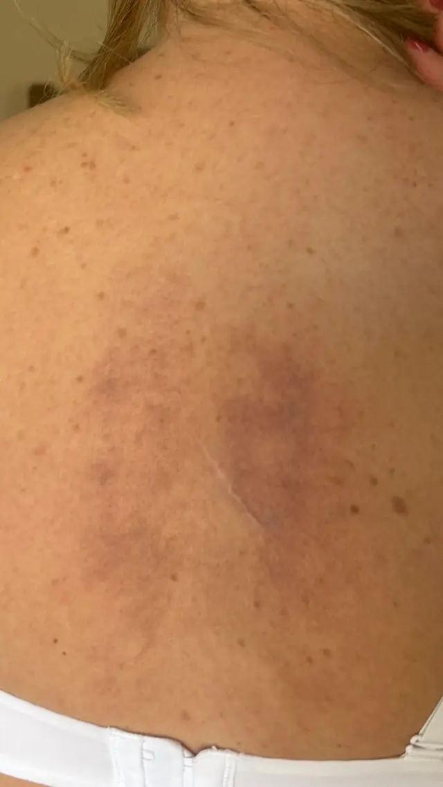 Rose Spa Massage E-3783 — customer photo 11