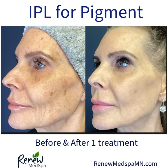Renew MedSpa — photo from the business 12