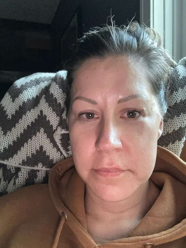 ReNew You Medical Spa — customer photo 10