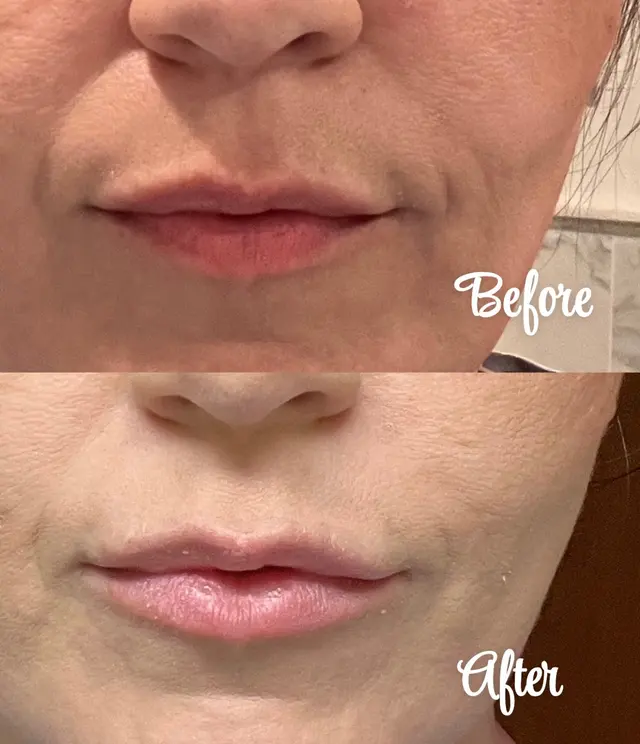 Customer photo of work by Aesthetica Skin Health & Wellness Clinic, Inc., from USMC's review