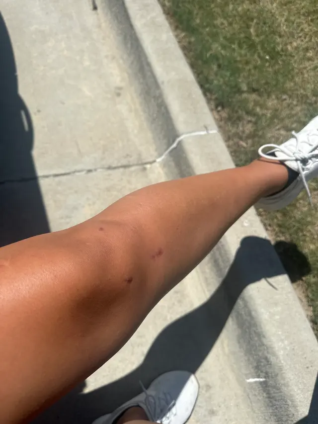Vista Physical Therapy - Lake Worth — customer photo 12