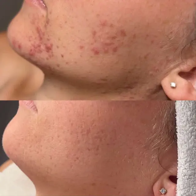 Skin & Soul Aesthetics — customer photo 9