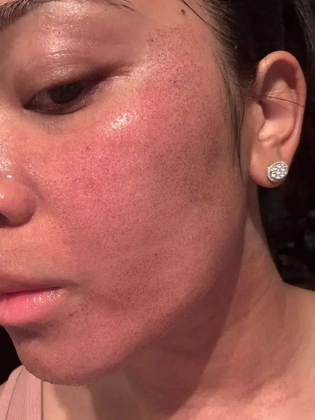 Customer photo of work by Face & Beyond Aesthetic Lounge, from Chriszelle Francia's review