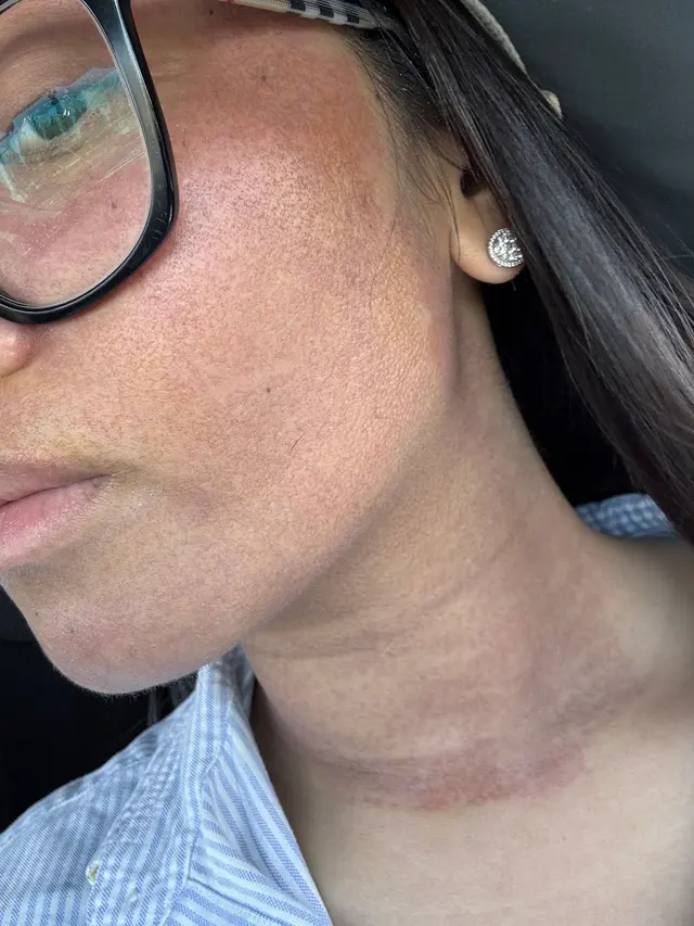 Customer photo of work by Face & Beyond Aesthetic Lounge, from Chriszelle Francia's review