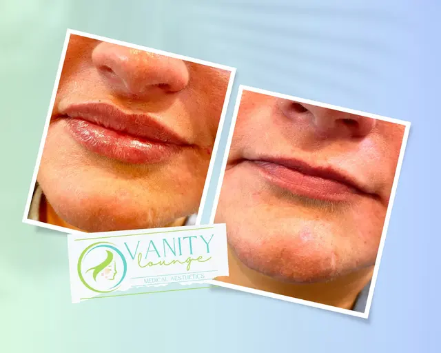 VANITY LOUNGE Medical Aesthetics — photo from the business 3