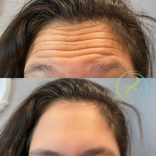 VANITY LOUNGE Medical Aesthetics — photo from the business 4