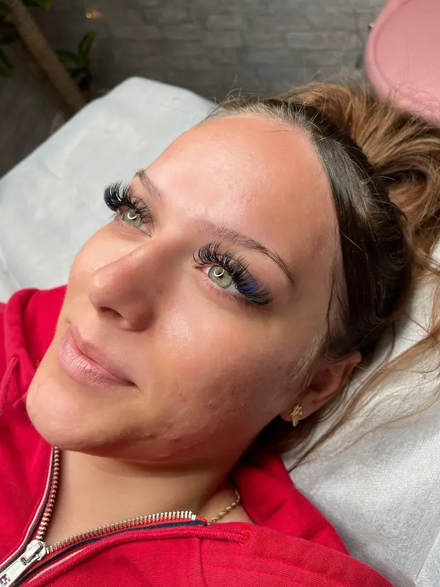 Rêver Esthetics — customer photo 11