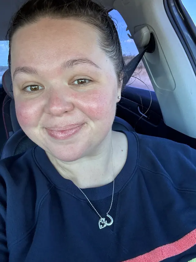 Customer photo of work by Hello Glow Aesthetics, from Shayla Hughes's review