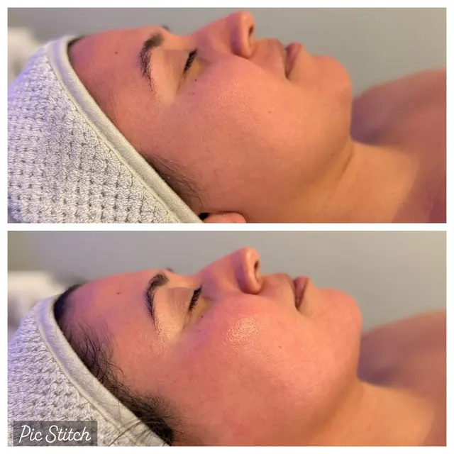 Hello Glow Aesthetics — photo from the business 10