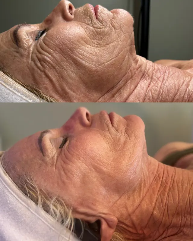 Hello Glow Aesthetics — photo from the business 5