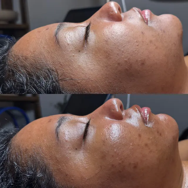 Double Cleanse Skin LLC — photo from the business 4