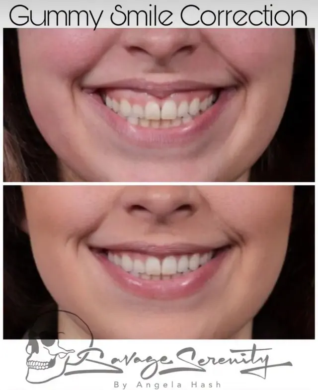 Customer photo from Nicole's review