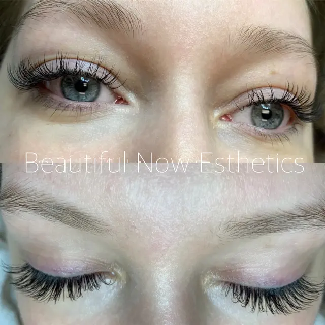 Beautiful Now Esthetics — photo from the business 9