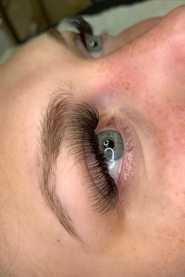 Beautiful Now Esthetics — photo from the business 4