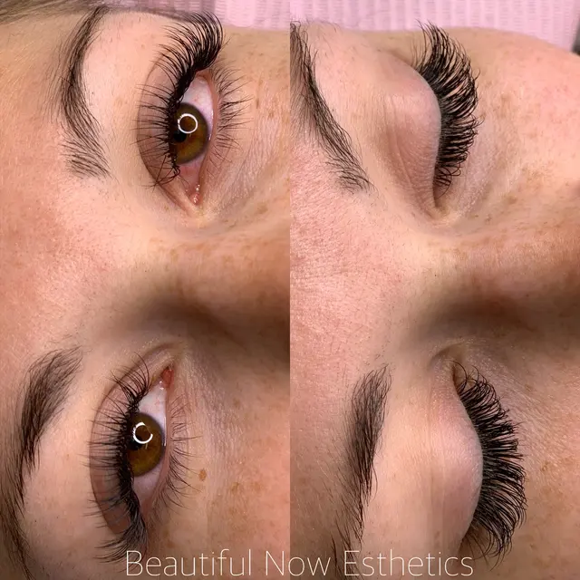 Beautiful Now Esthetics — photo from the business 11