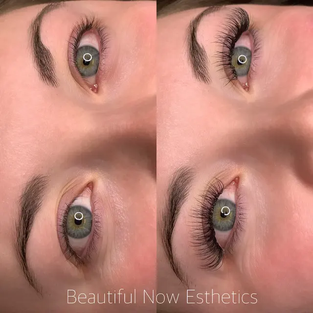 Beautiful Now Esthetics — photo from the business 10