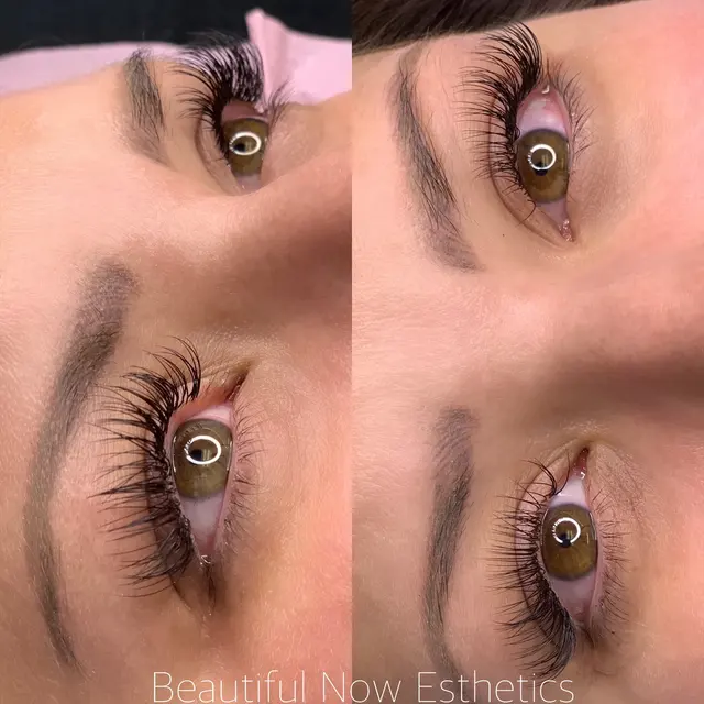 Beautiful Now Esthetics — photo from the business 12