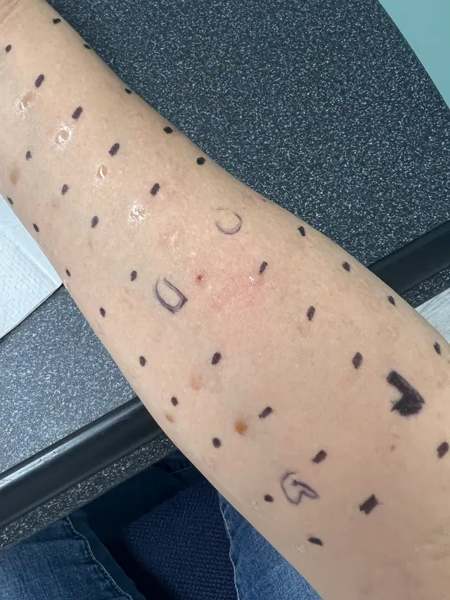 Allergy and Asthma Specialist Doctors, Inc. — customer photo 10