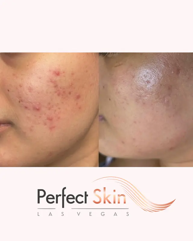 Perfect Skin Las Vegas LLC — photo from the business 10