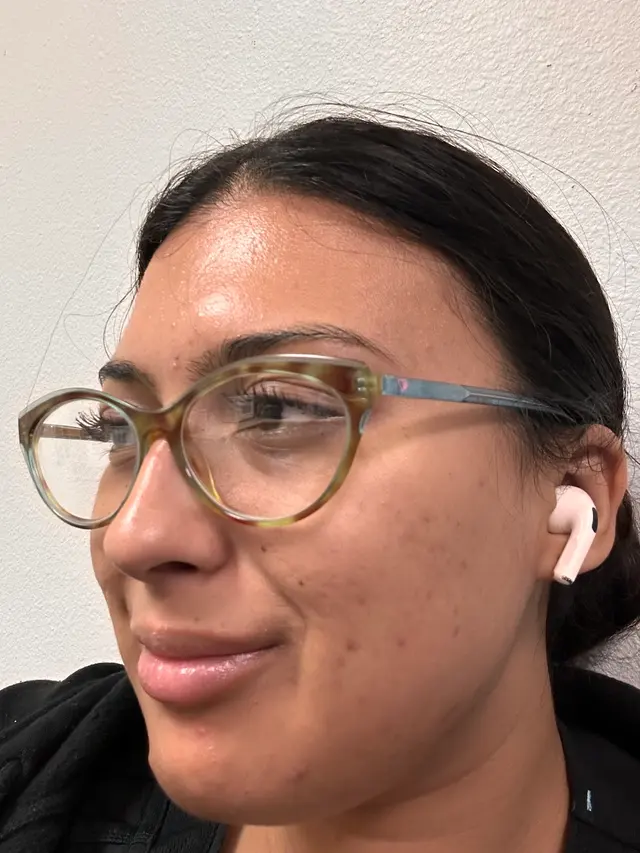 Perfect Skin Las Vegas LLC — customer photo 11