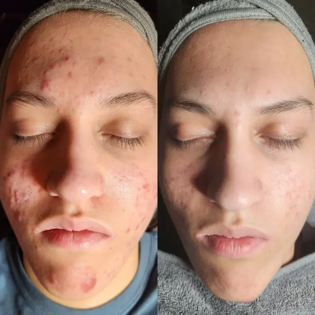Serenity Skin LLC — photo from the business 5