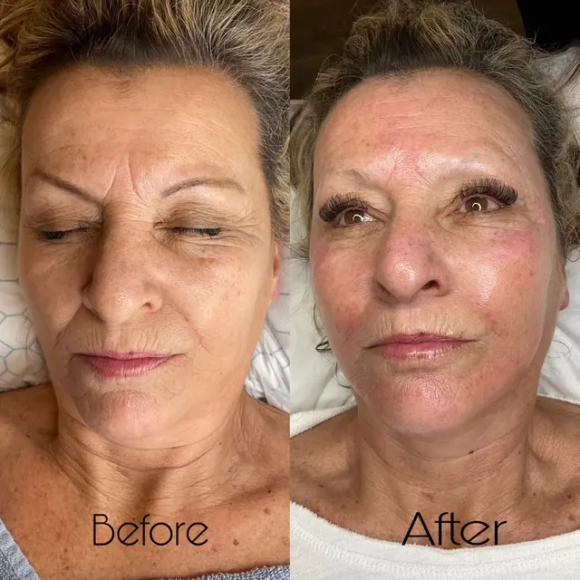Ybonis Beauty Spa — photo from the business 7
