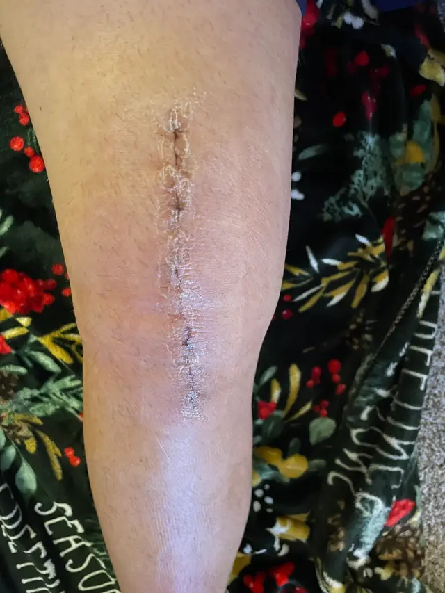 Matthew E. Lovell, M.D. — customer photo 5