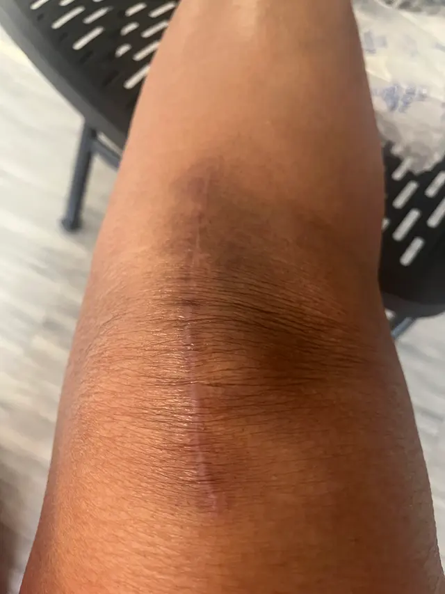 Michael E. Berend, MD — customer photo 6