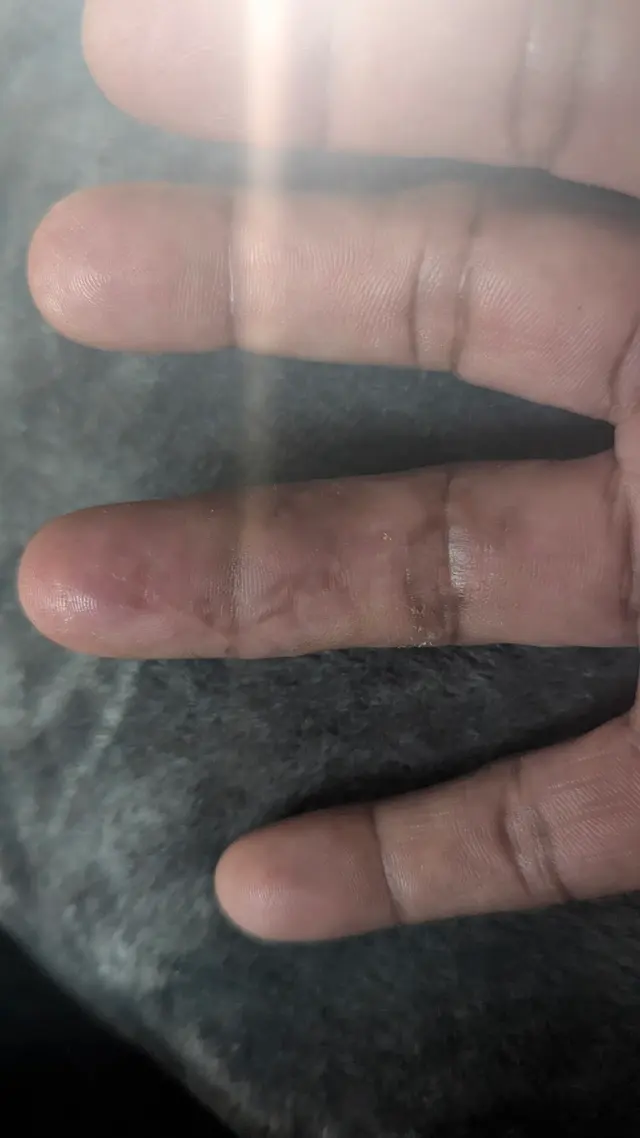 Orthopedic hand doctor: Christy Kellams, MD — customer photo 7