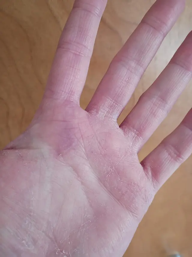 Orthopedic hand doctor: Christy Kellams, MD — customer photo 5