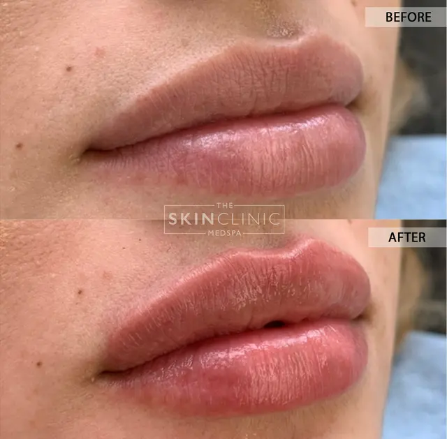 THE SKIN CLINIC MED SPA — photo from the business 10