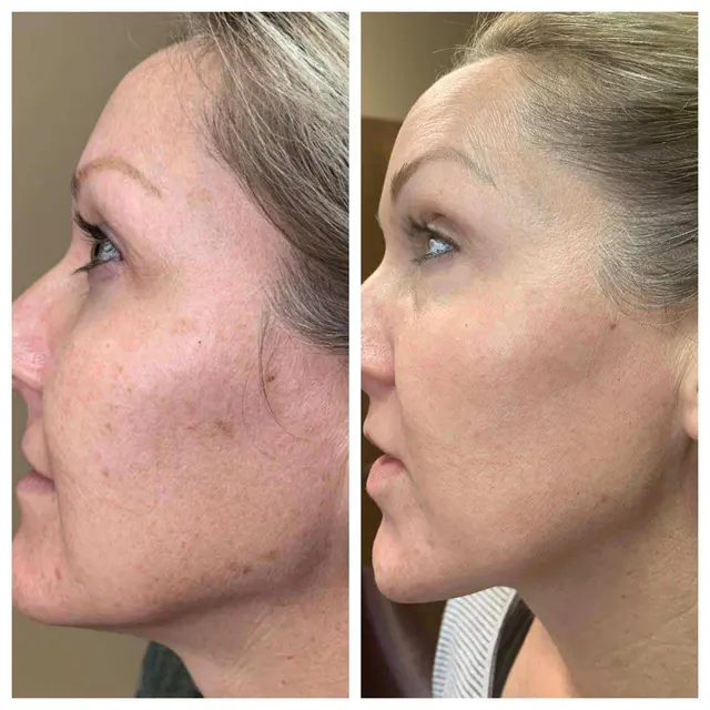 Quinn Aesthetics — customer photo 9