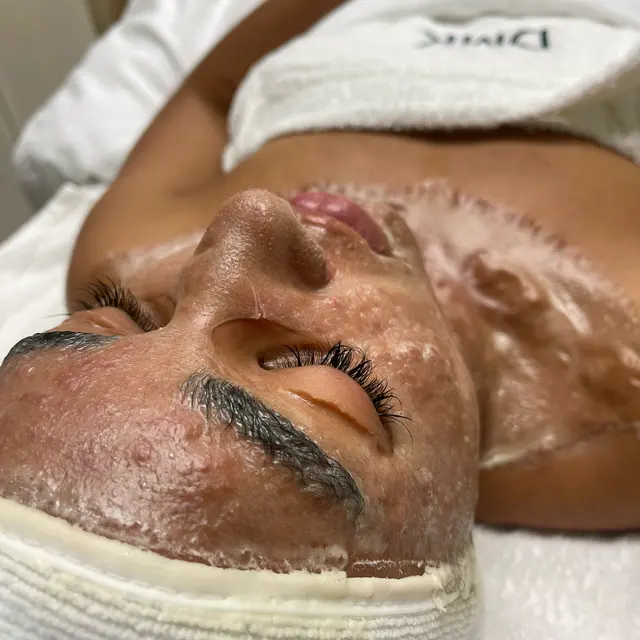 Evolution Skyn Aesthetics - Dermaplaning + Acne Expert + DMK Facialist — photo from the business 1