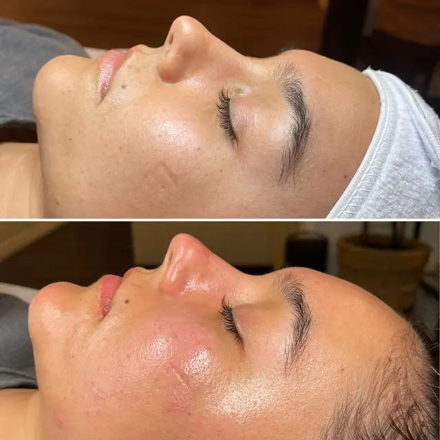 Evolution Skyn Aesthetics - Dermaplaning + Acne Expert + DMK Facialist — photo from the business 12