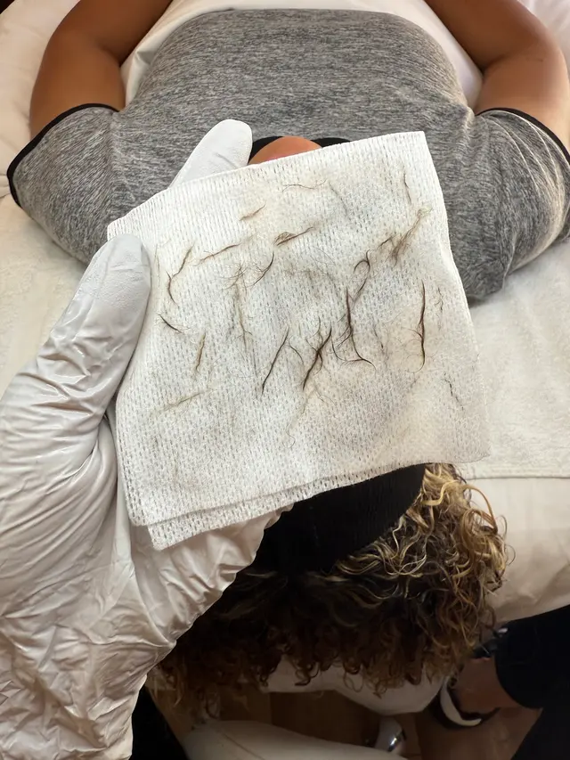 Evolution Skyn Aesthetics - Dermaplaning + Acne Expert + DMK Facialist — photo from the business 7