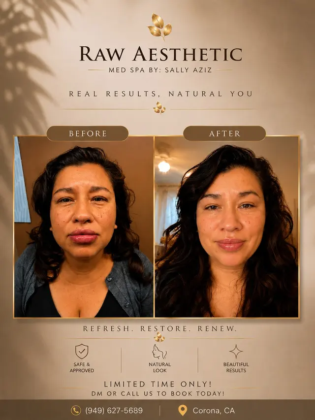 Raw Aesthetic Medical Spa by Sally Aziz — photo from the business 1