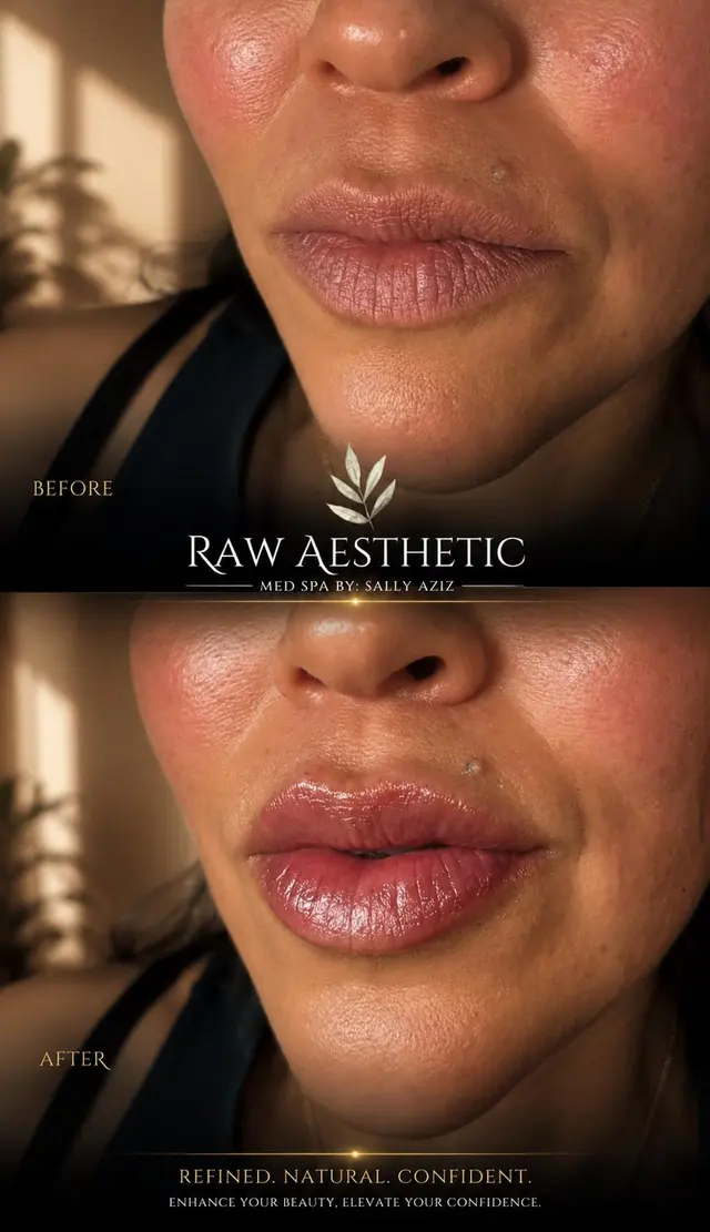 Raw Aesthetic Medical Spa by Sally Aziz — photo from the business 6