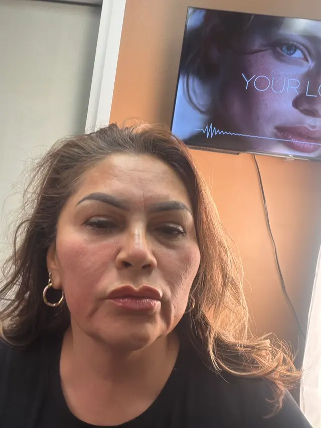 Customer photo of work by Raw Aesthetic Medical Spa by Sally Aziz, from Silveria Becerra's review